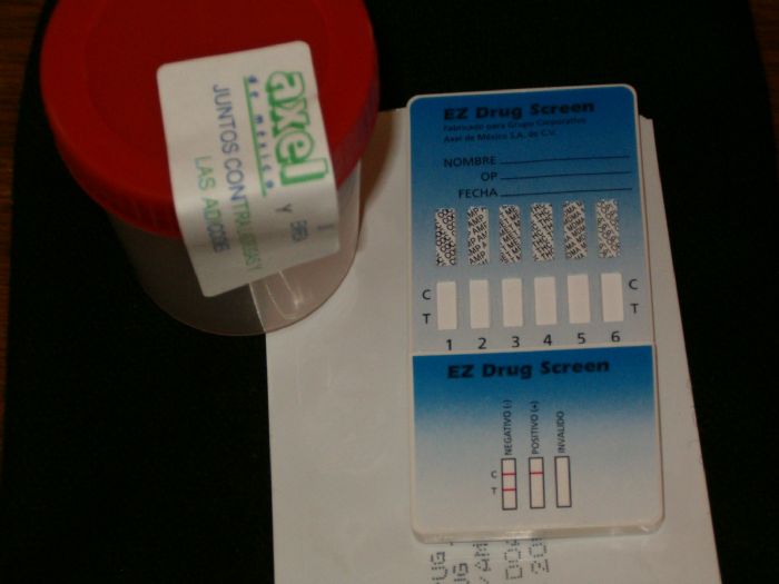 pruebas antidoping